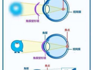 把男生的坤巴放在女生的定眼里，定制专业近视眼镜，清晰视野，舒适体验