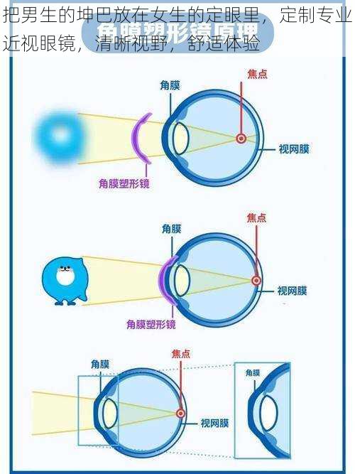 把男生的坤巴放在女生的定眼里，定制专业近视眼镜，清晰视野，舒适体验