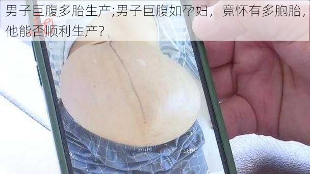 男子巨腹多胎生产;男子巨腹如孕妇，竟怀有多胞胎，他能否顺利生产？